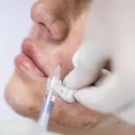BPOM: Skin Booster hADM Korsel Belum Berizin di Indonesia