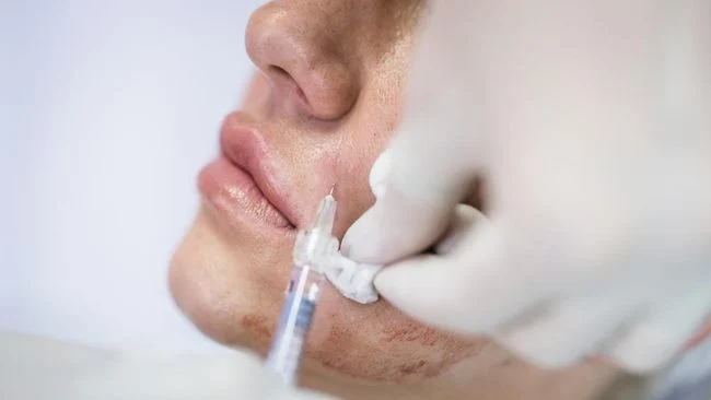 BPOM: Skin Booster hADM Korsel Belum Berizin di Indonesia